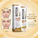 5.webp